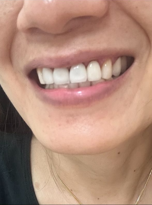 After